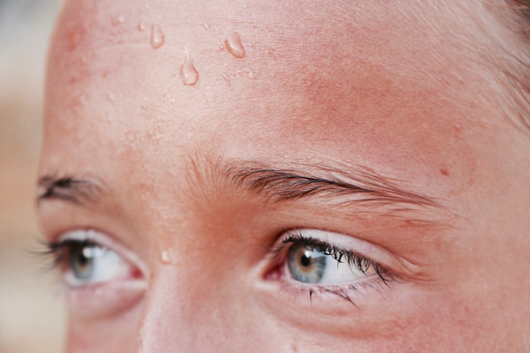 When Sweating Stops - The Anhidrosis Connection (image credits: unsplash)