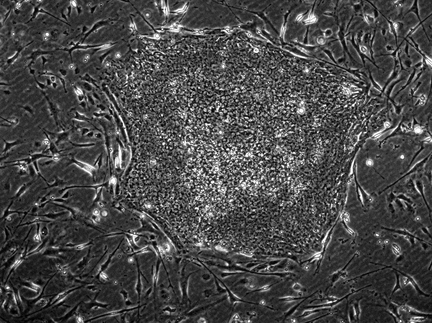 Stem Cells Are Being Reprogrammed to Build Missing Body Parts (image credits: wikimedia)