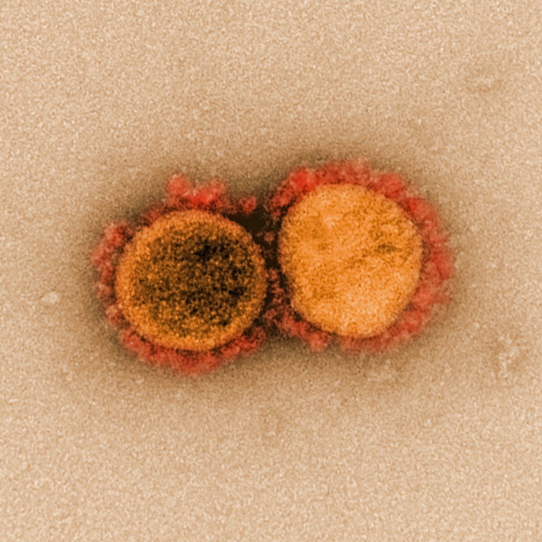 How Ancient Retroviruses Became Part of Us (image credits: unsplash)
