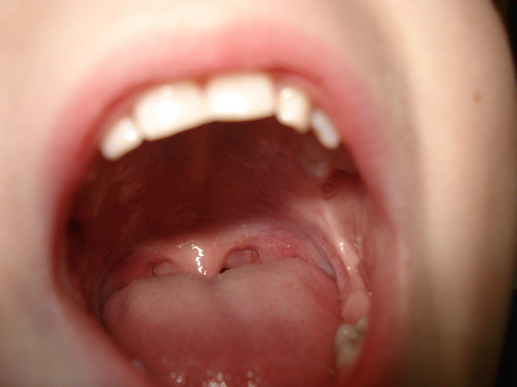 Your Mouth Contains More Bacteria Than There Are People on Earth (image credits: rawpixel)
