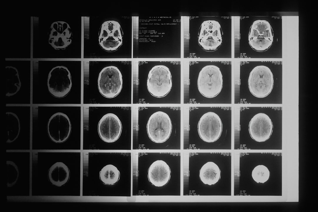 Brain Scans Reveal the Shocking Truth (image credits: unsplash)