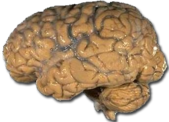 The Memory Paradox (image credits: wikimedia)
