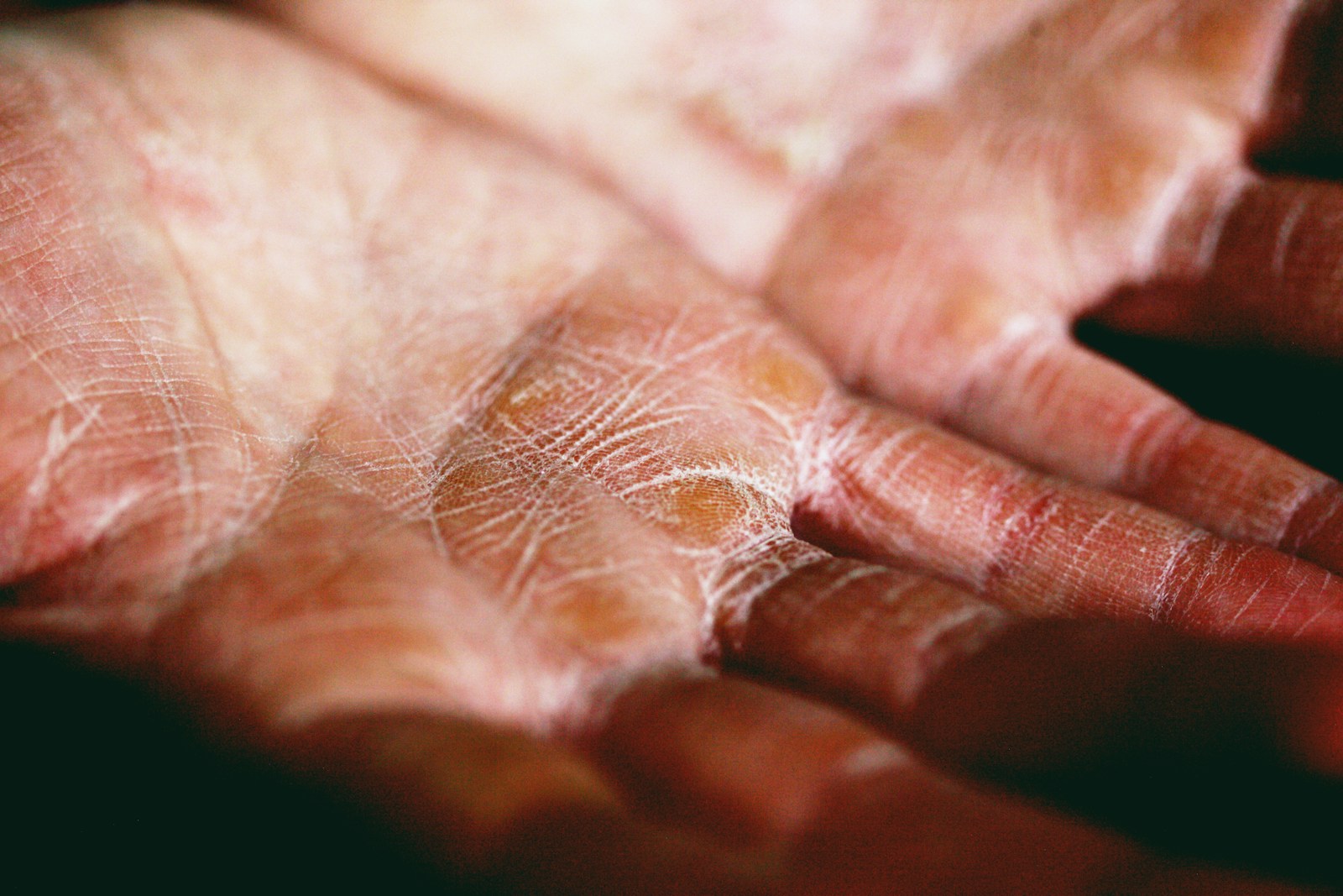 This Is How Scientists Are Trying to 3D Print Living Skin