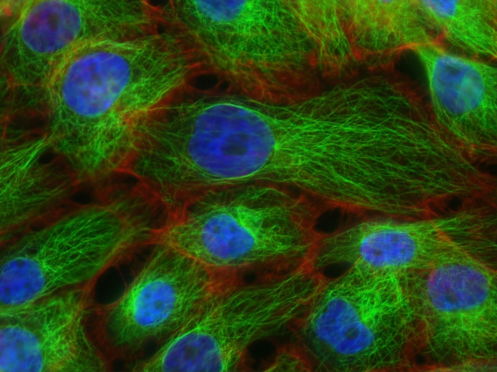 Planarian neoblast stem cells dividing under a microscope.