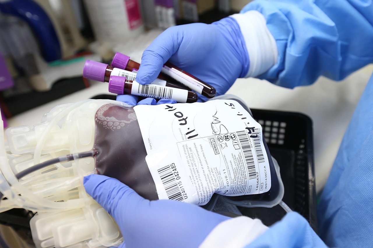 Blood Factors and Age Reversal (image credits: pixabay)