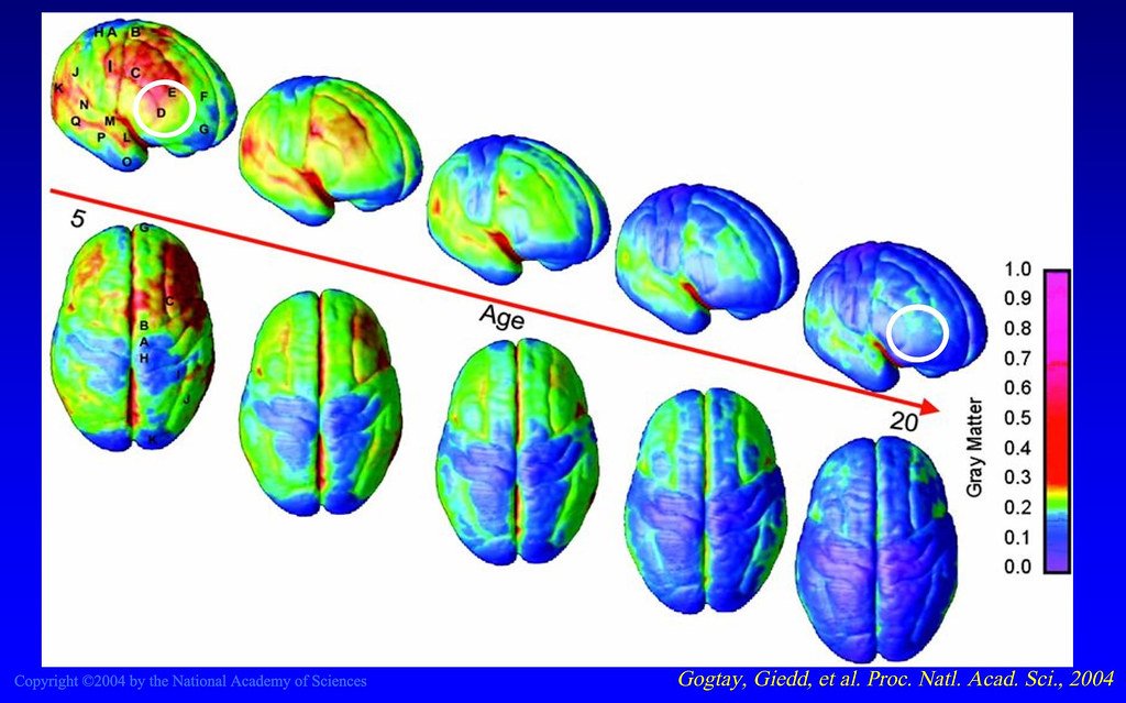 Testing for This Rare Condition (image credits: flickr)