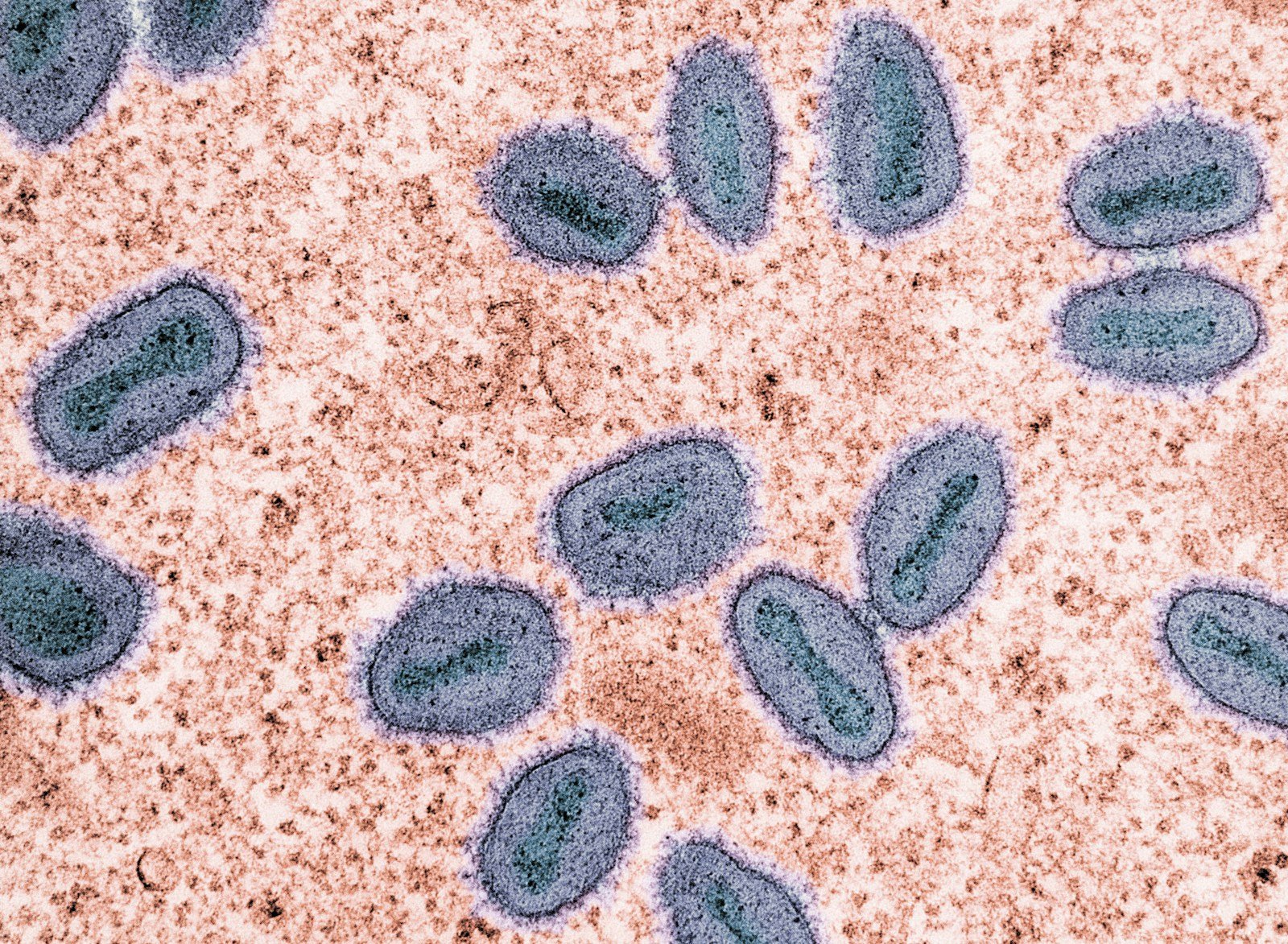 The Forgotten Microbes That Made Oxygen Before Trees Did