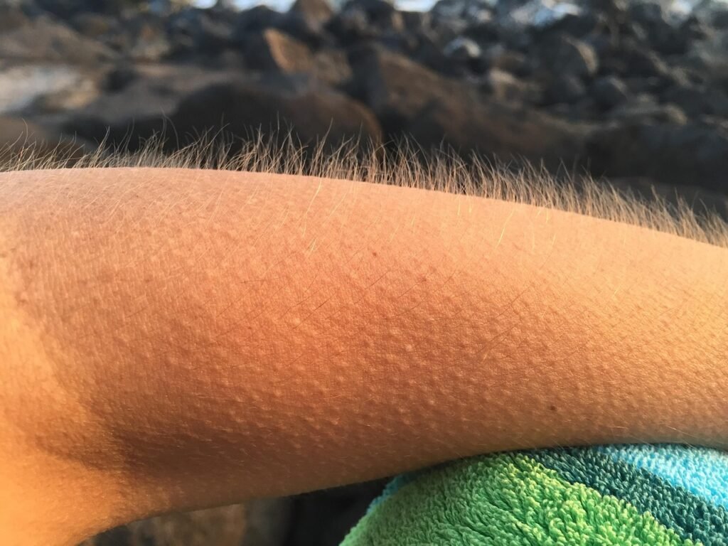 Why Do We Get Goosebumps? The Science of Our Reactions