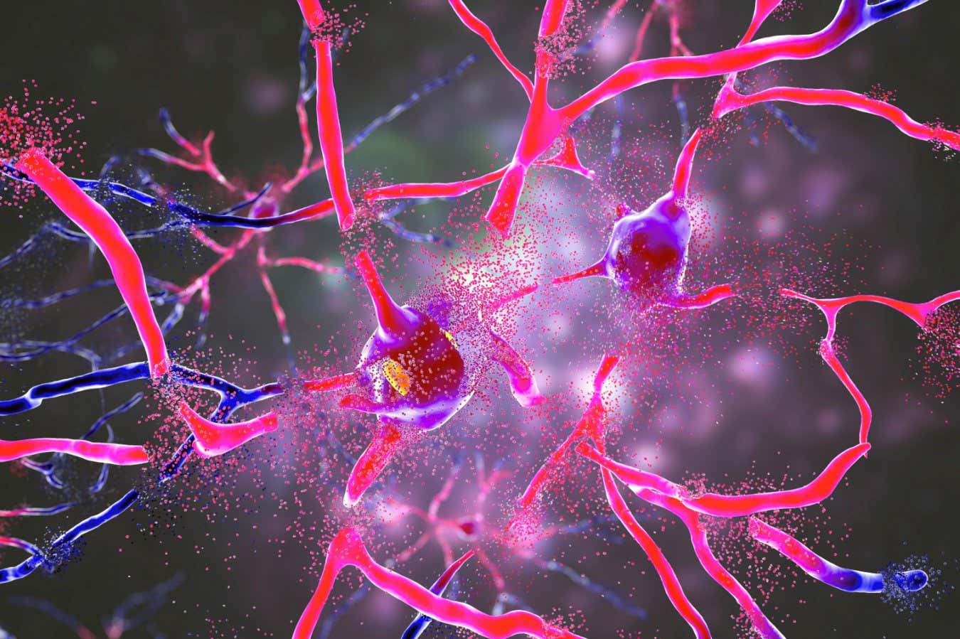 Landmark Gene Therapy Breakthrough Offers Hope Against Huntington’s Disease