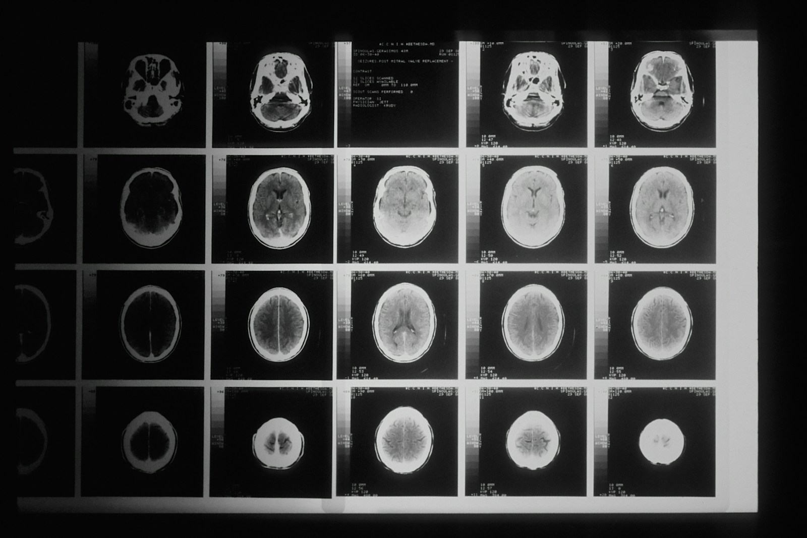 Inside the Human Brain: The Most Mysterious Biological Machine on Earth