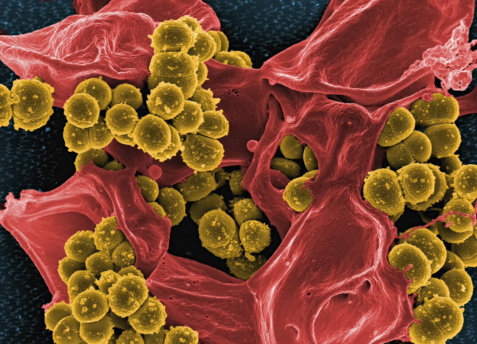 Your Gut Microbiome: A Hidden Universe Inside You
