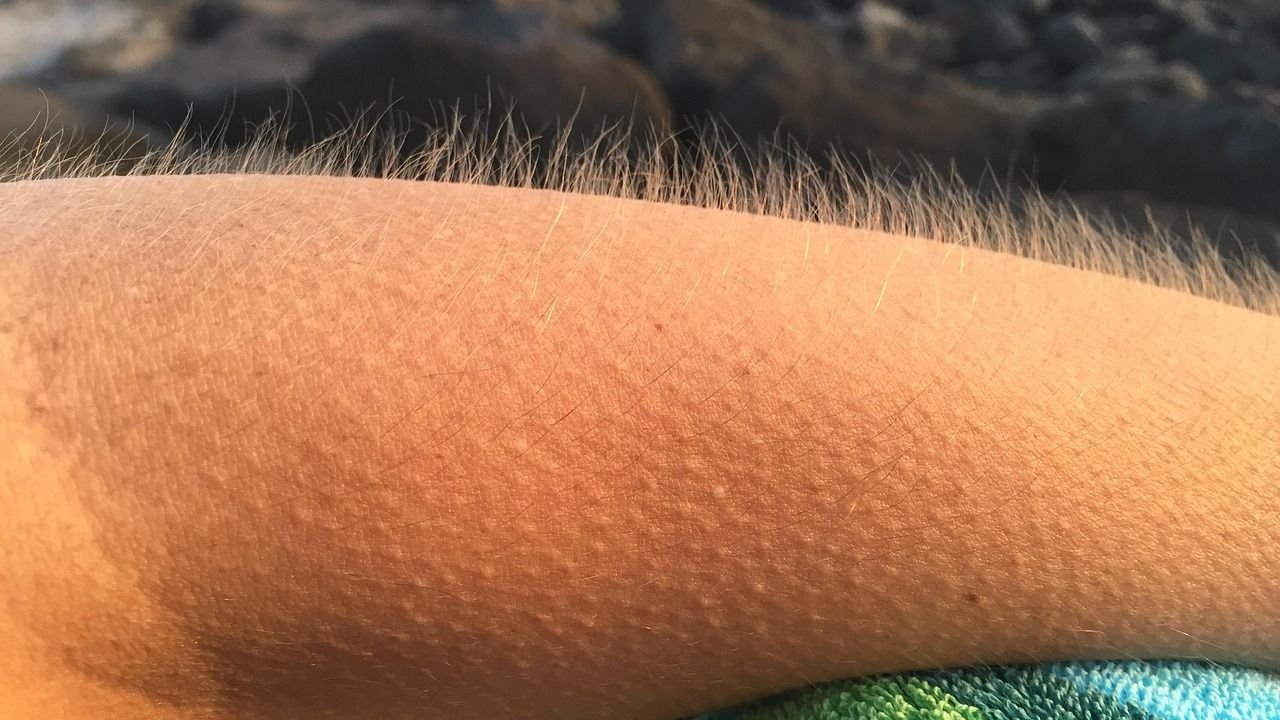 Why Do We Get Goosebumps? The Evolutionary Reason for Our Skin’s Reaction