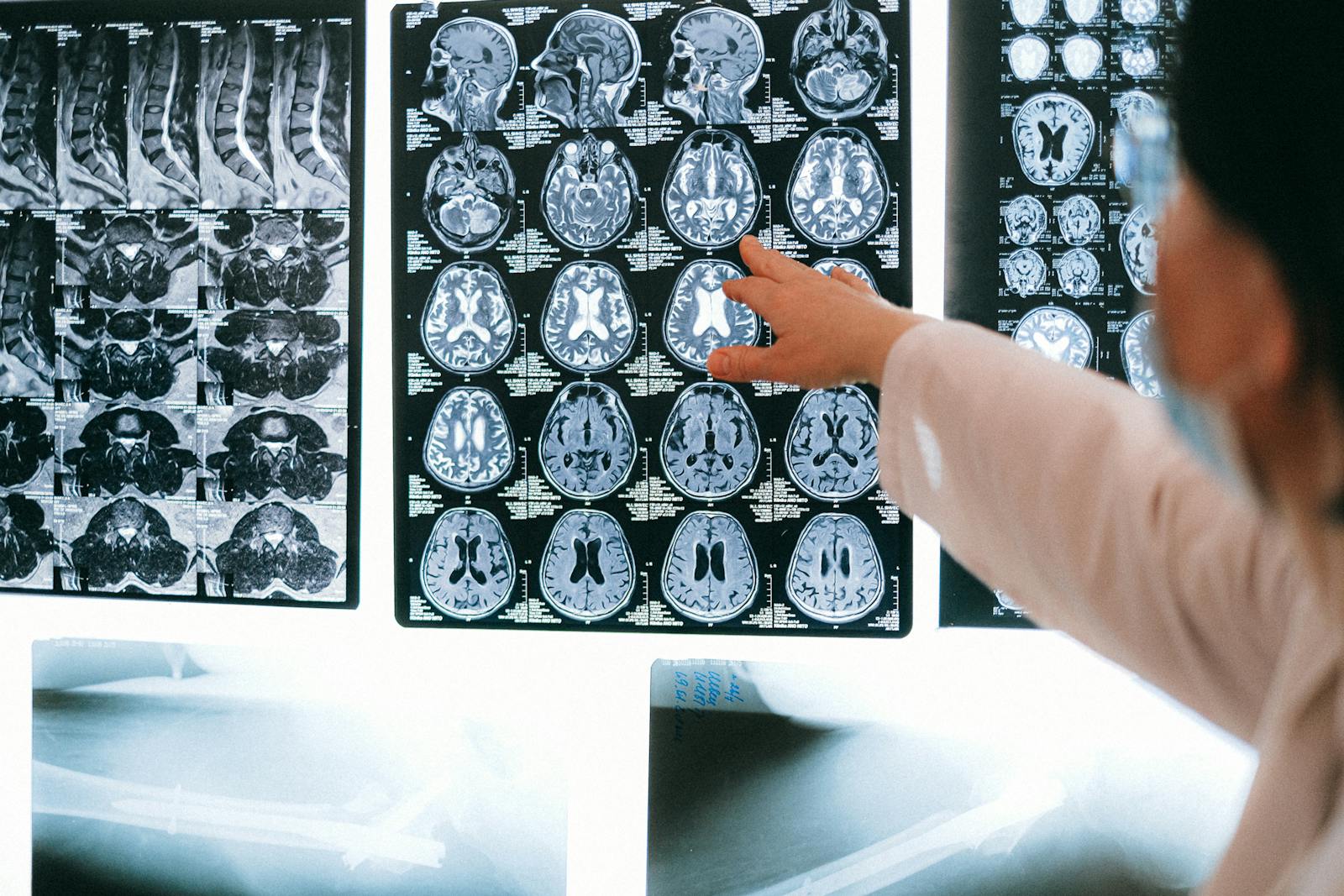 Every Human Brain Holds Unexplored Connections: The Power of Neuroplasticity