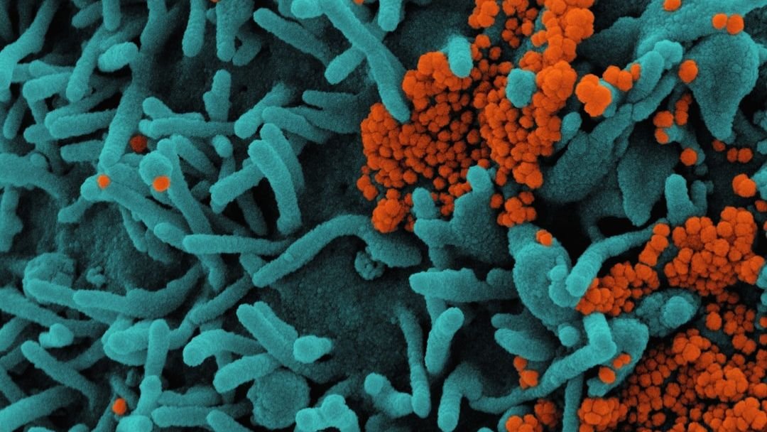 Microbes Rule the World: The Hidden Kingdom Shaping Our Planet