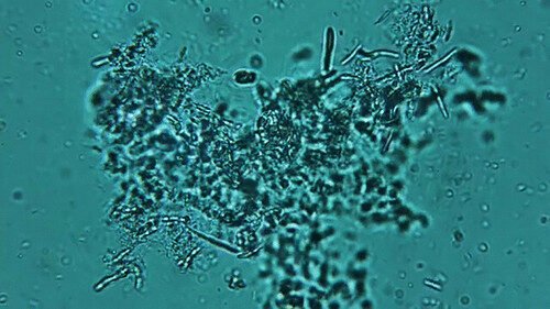 Digging Deeper: Why Subsurface Life May Be the Key to Everything