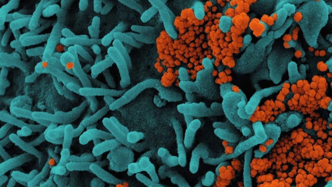 The Hidden World of Microbes: How Tiny Life Shapes Our Planet