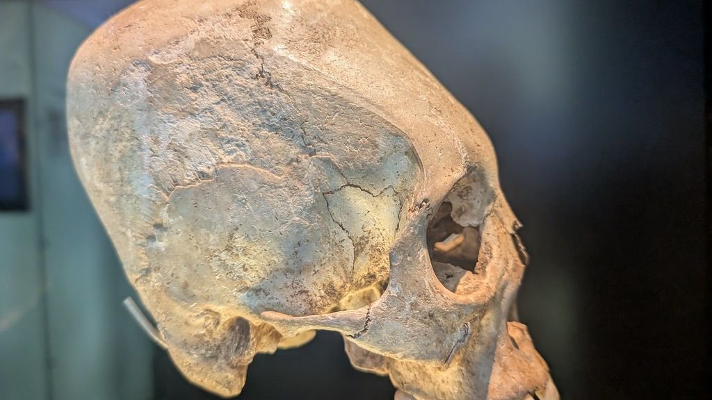 Ancient Elongated Skulls Found On Every Continent Except Antarctica - Scientists Are Finally Explaining Why