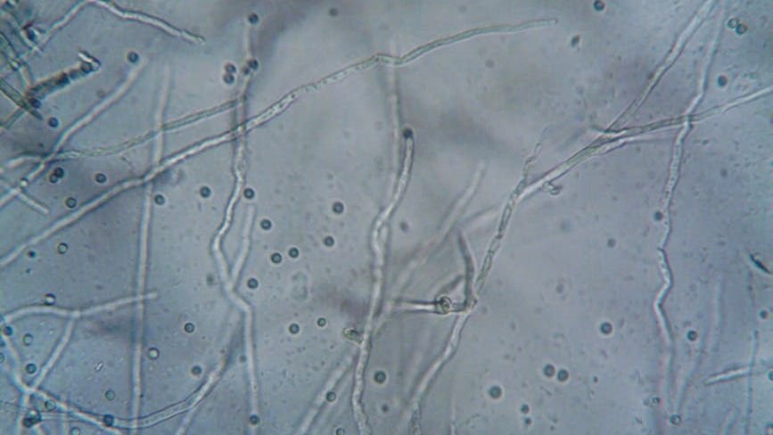 Beyond the Ice: Discovering Ancient Microbes in Earth's Frozen Frontiers