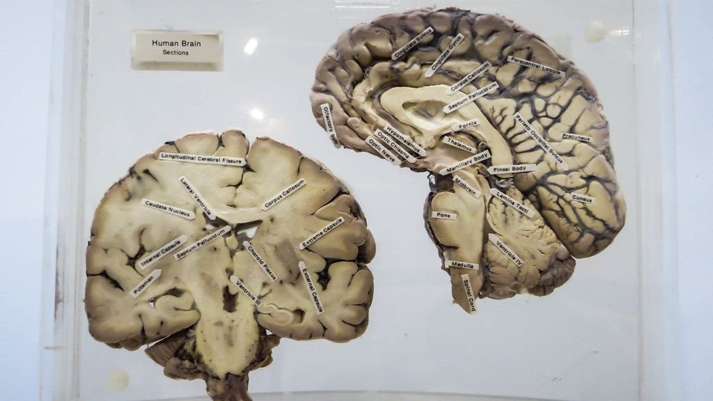 The Human Brain Is Still the Most Complex Object We Have Ever Discovered in the Universe