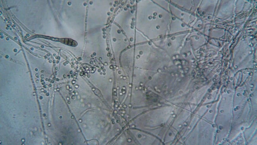 The Unseen Architects: Tiny Organisms That Control Earth's Giant Ecosystems