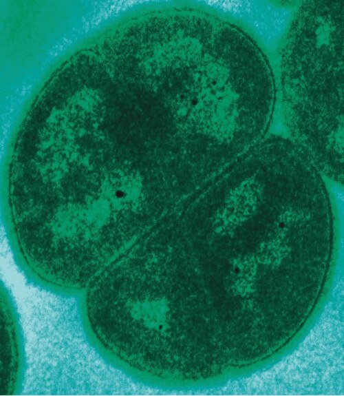 Deinococcus Radiodurans: The Bacterium That Laughs at Radiation