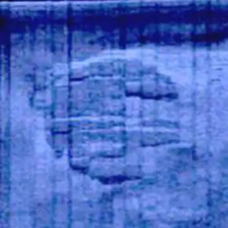 #2 The Baltic Sea “Anomaly”: Natural Rock, Ancient Structure, Or Something Else?