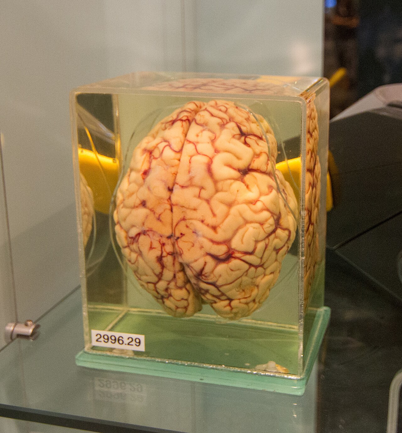 5. Dissected Medical Specimens That Forgot The Person 
