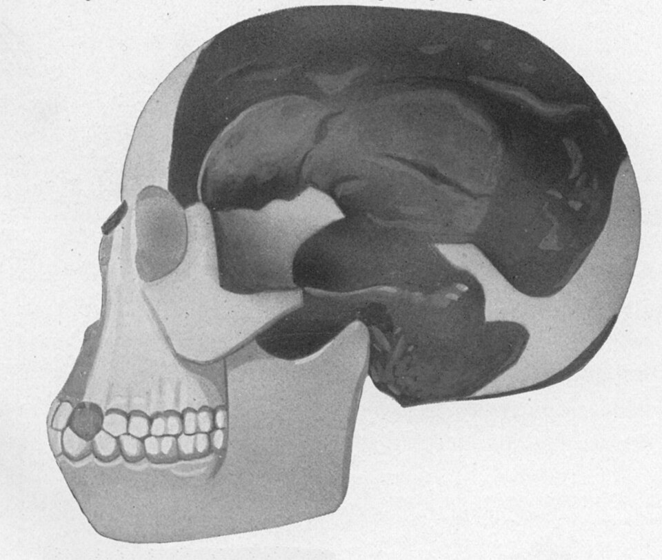 The Piltdown Man Hoax And The Embarrassed Establishment 