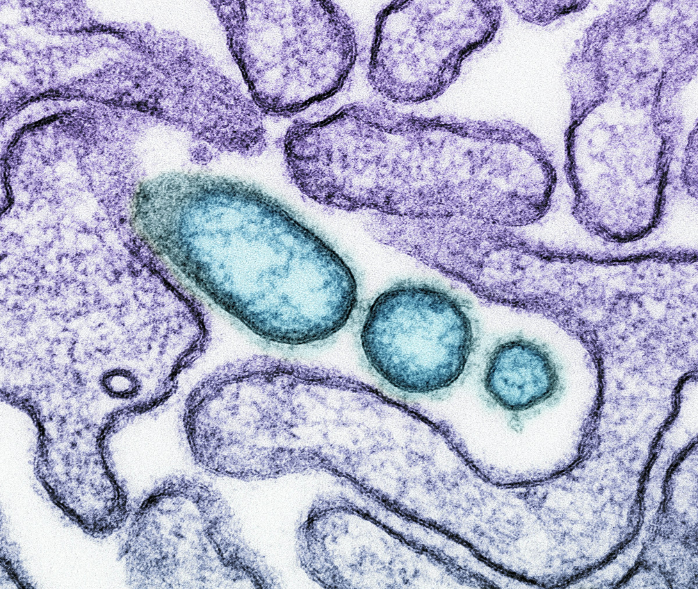 The Cellular Reason Aging Eventually Leads to Death