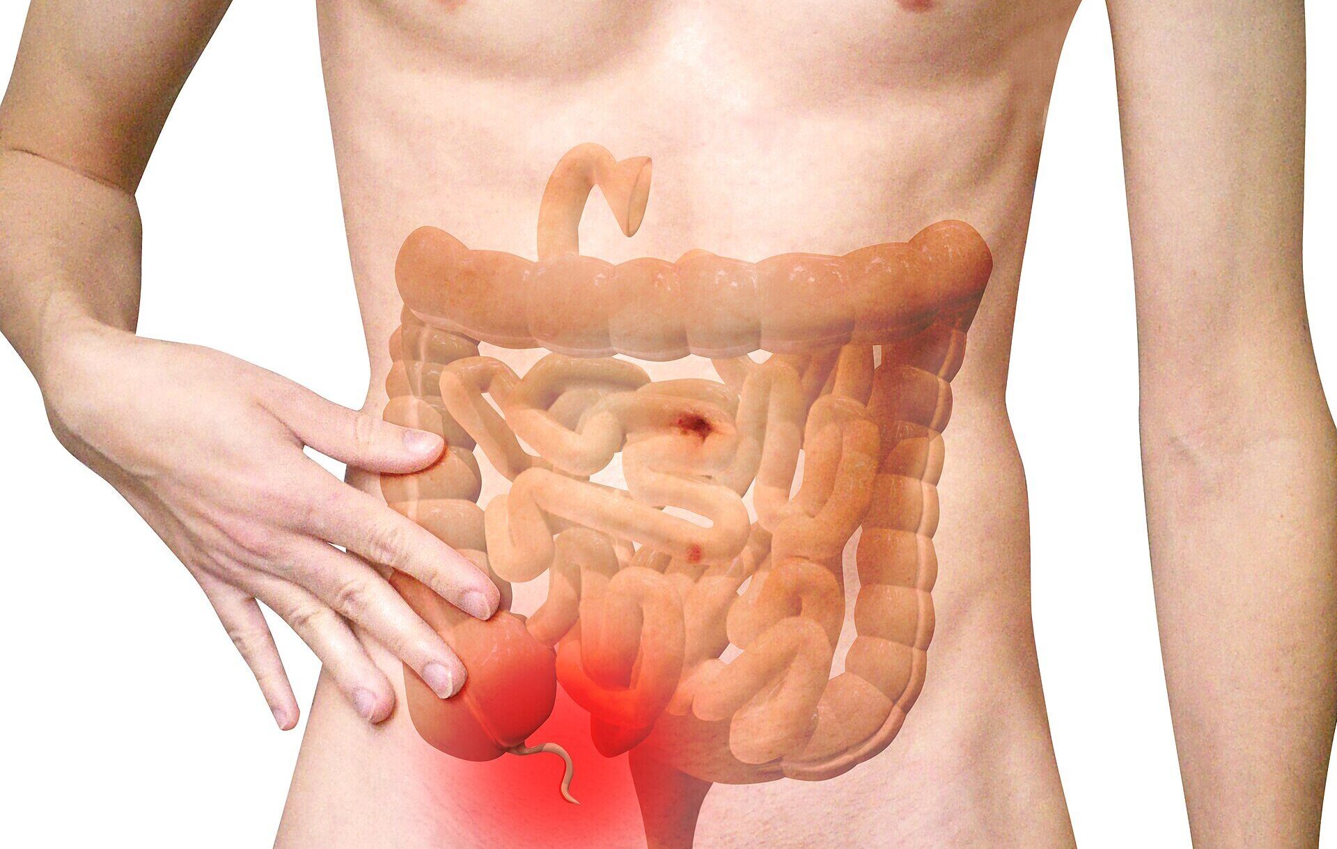 The Appendix: Dangerous Leftover or Immune Backup System?