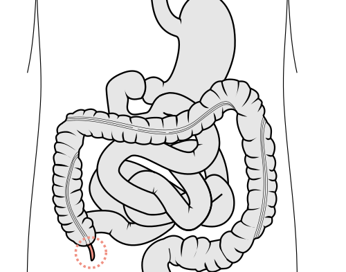 Immune System Training Ground in Your Gut
