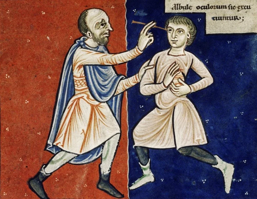 Celsus’ De Medicina: Cataract Surgery That Sounded Impossible