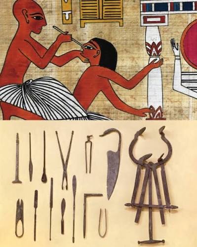 Egyptian Medical Papyri: From “Magic” Spells to Proven Surgical Toolkits