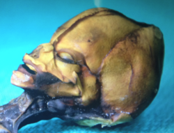 #6 - The "Alien" Atacama Skeleton That Defied First Impressions