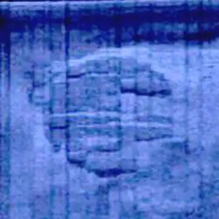 The Baltic Sea “Anomaly” and Submerged Stone Structures