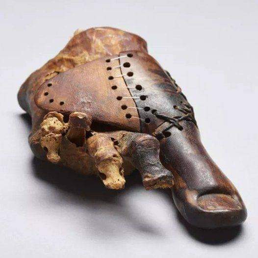 9. Gold Bridgework and a Wooden Toe People Actually Wore