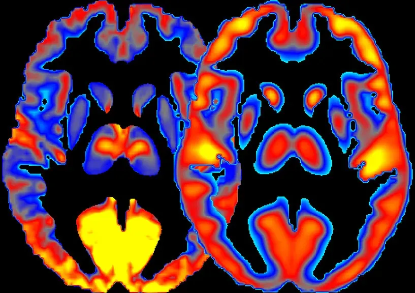 Researchers Have Discovered That the Brain Continues Generating Complex Coordinated Activity for Up to 30 Seconds After Clinical Death - and Nobody Agrees on What That Means
