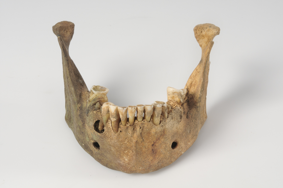 12 Things Early Human Teeth Give Away About a Whole Life